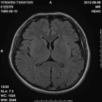 20120810_MRI.jpg